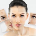 Điều trị mụn trứng cá hiệu quả tại Phòng khám Da liễu bác sỹ Thái Hà